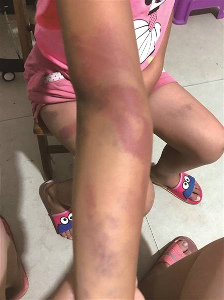 女孩打暑假工被拍屁股,警方介入,这事没那么简单 女孩打暑假工被拍屁股,警方介入,这事没那么简单